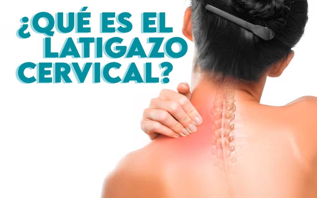 ¿Qué es el famoso síndrome de latigazo cervical y como tratarlo?