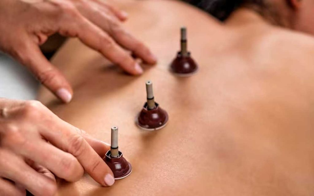 para que sirve la moxibustion