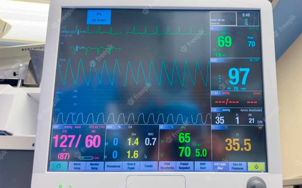 Monitoreo signos vitales en enfermería