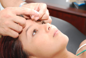 estética facial con acupuntura