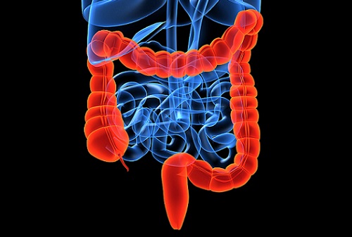 enfermedades inflamatorias intestinales