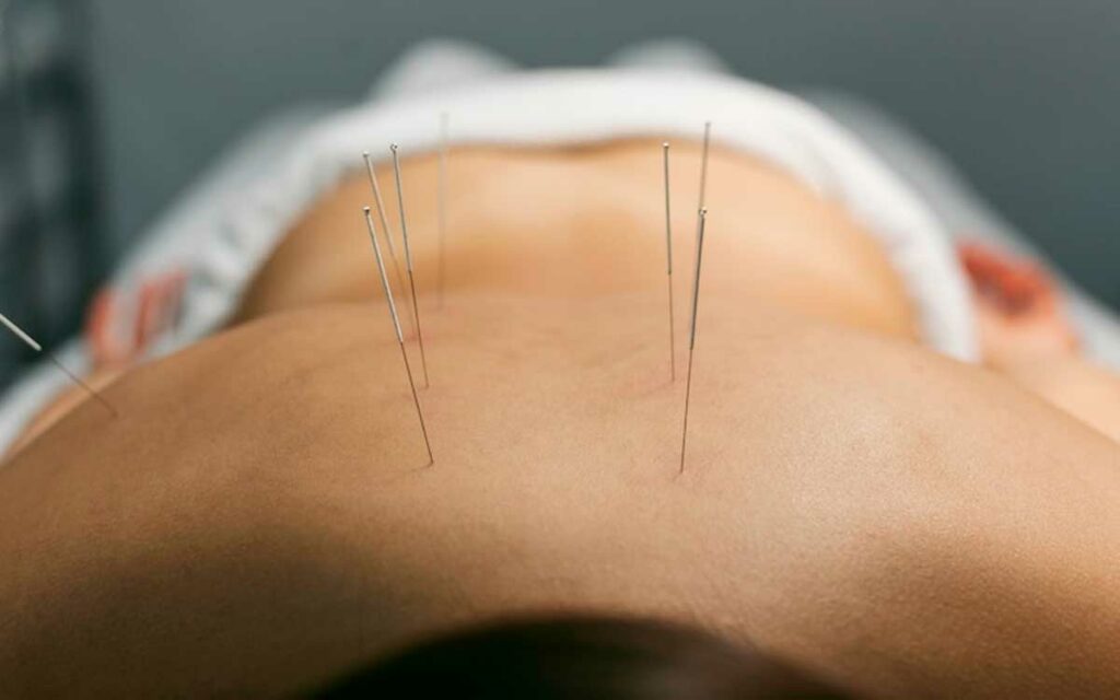tratamiento de acupuntura para dolor cronico