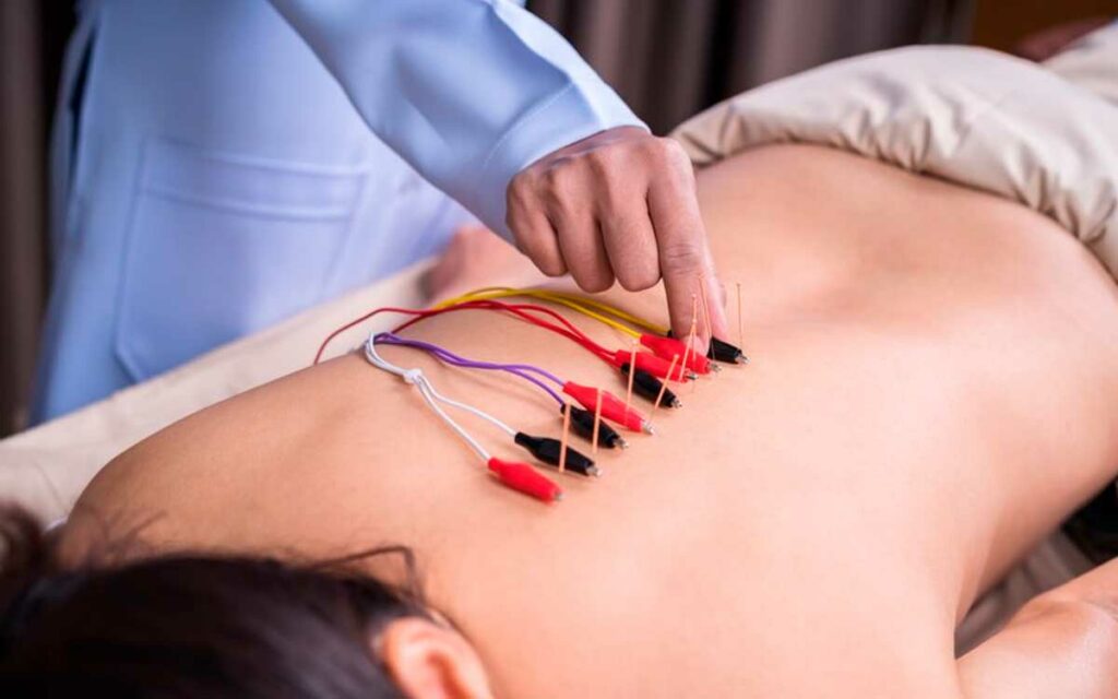 costo de curso acupuntura cdmx