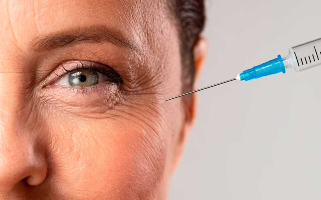 aplicar botox en lineas de la edad