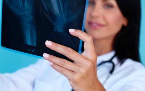 uso de la radiología y quiropractica
