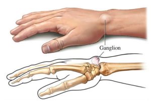 Imagen recuperada de freepik