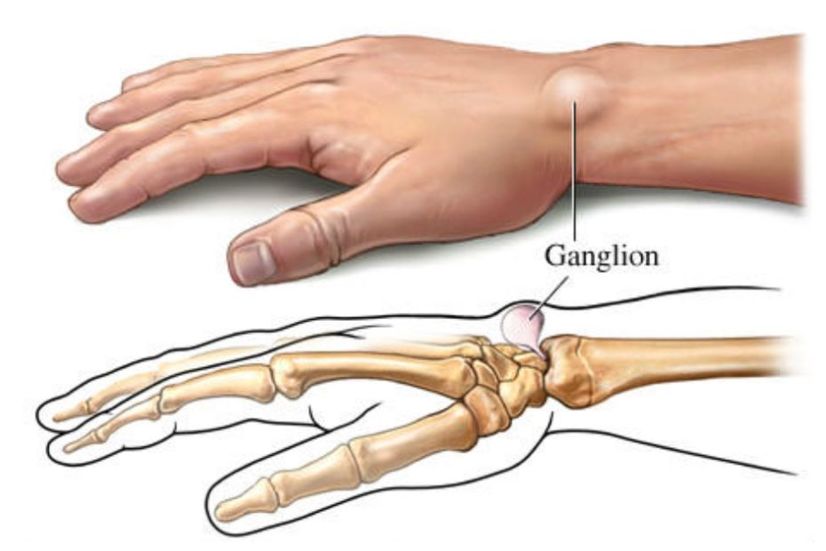 Imagen recuperada de freepik