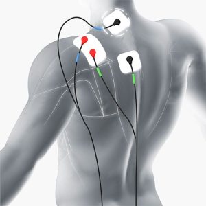 alt("electroacupuntura")