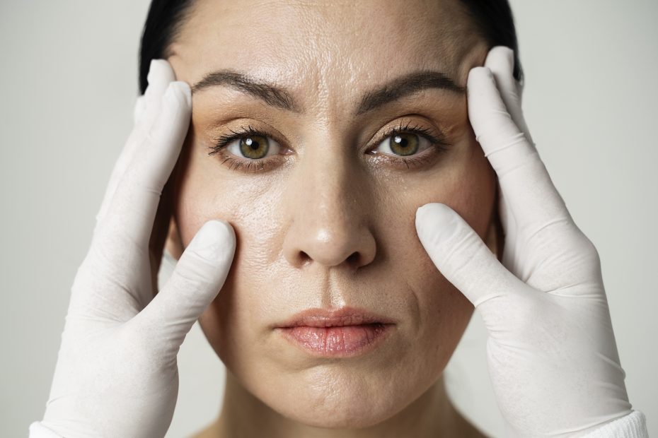 alt"beneficios-del-botox"